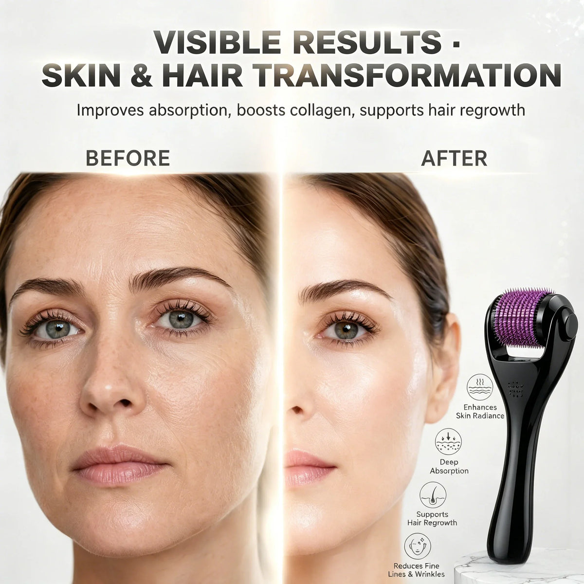 Zandor Derma Roller™